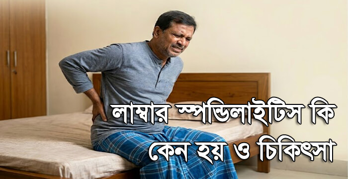 লাম্বার স্পন্ডিলাইটিস কি, কেন হয় ও চিকিৎসা